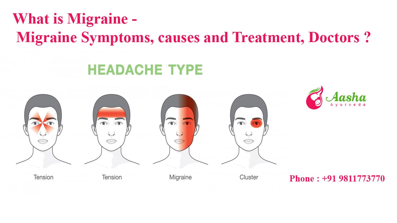 What is Migraine - Migraine Symptoms, causes and Treatment, Migraine Doctors ?