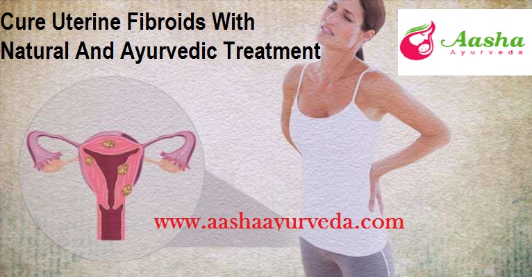 Cure Uterine Fibroids With Natural And Ayurvedic Treatment