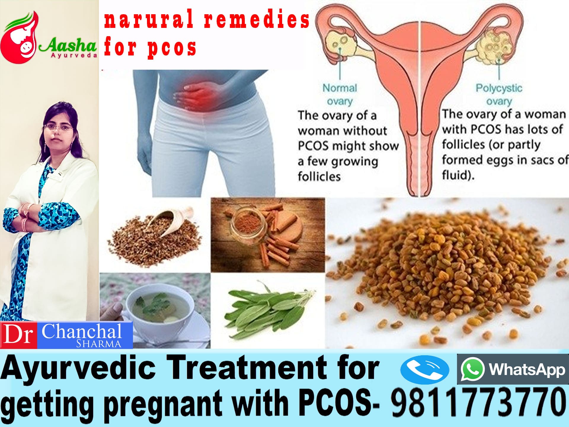 Ayurvedic Treatment for Getting Pregnant with PCOS